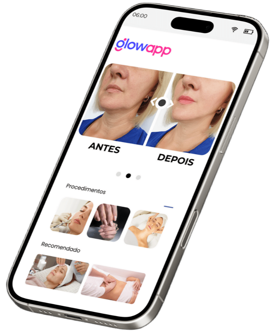 Imagem antes e depois